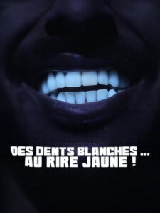 Des dents blanches… au rire jaune !